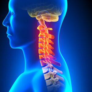 Cervical Radiculopathy PHYSIOCARE PHYSIOTHERAPY